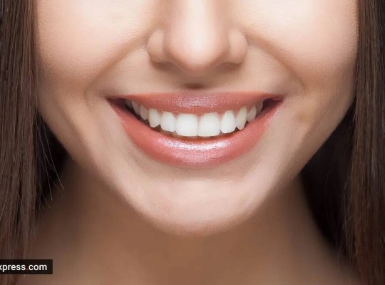 Can a combination of kiwi, cucumber, and baking soda help whiten teeth?