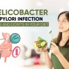 Helicobacter Pylori infection: Do's and do...
